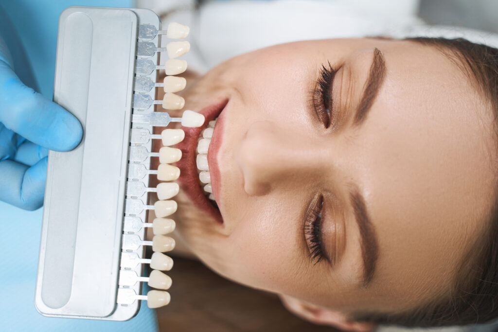 Porcelain veneers in Southern Pines, NC